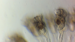 Conochilus hippocrepis