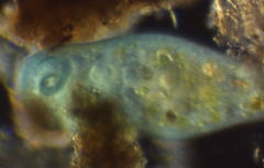 Stentor coeruleus