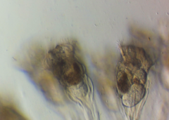 Conochilus hippocrepis