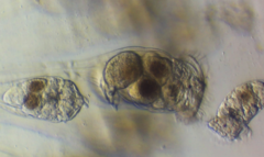 Conochilus hippocrepis