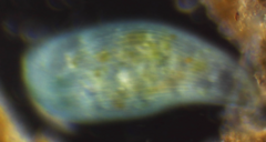 Stentor coeruleus