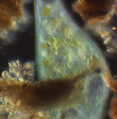 Stentor coeruleus