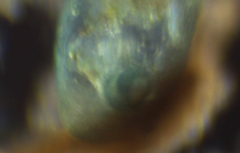 Stentor coeruleus