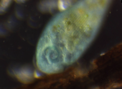 Stentor coeruleus