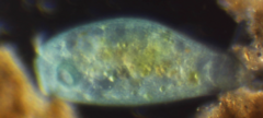 Stentor coeruleus