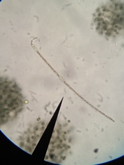 Anabaena