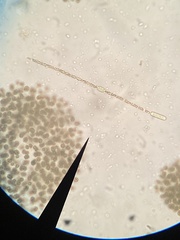 Anabaena