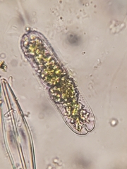 Tetmemorus brebissonii