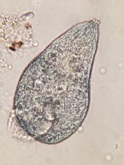 Stentor multiformis
