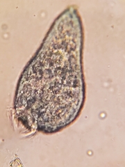 Stentor multiformis