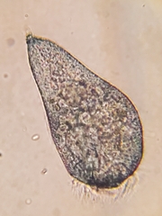 Stentor multiformis