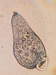 Stentor multiformis