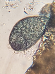 Stentor multiformis