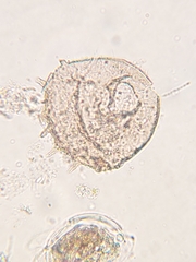 Centropyxis aculeata