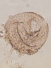 Centropyxis aculeata