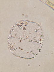 Micrasterias truncata