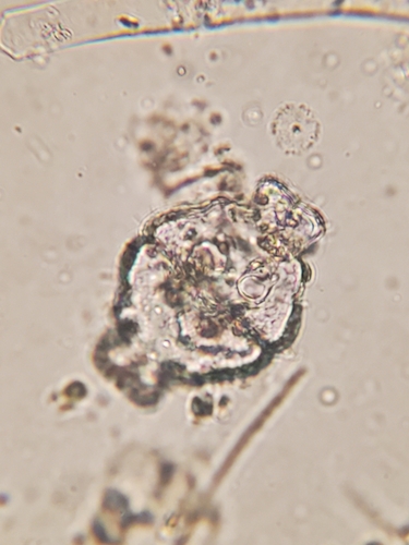 Euastrum ampullaceum