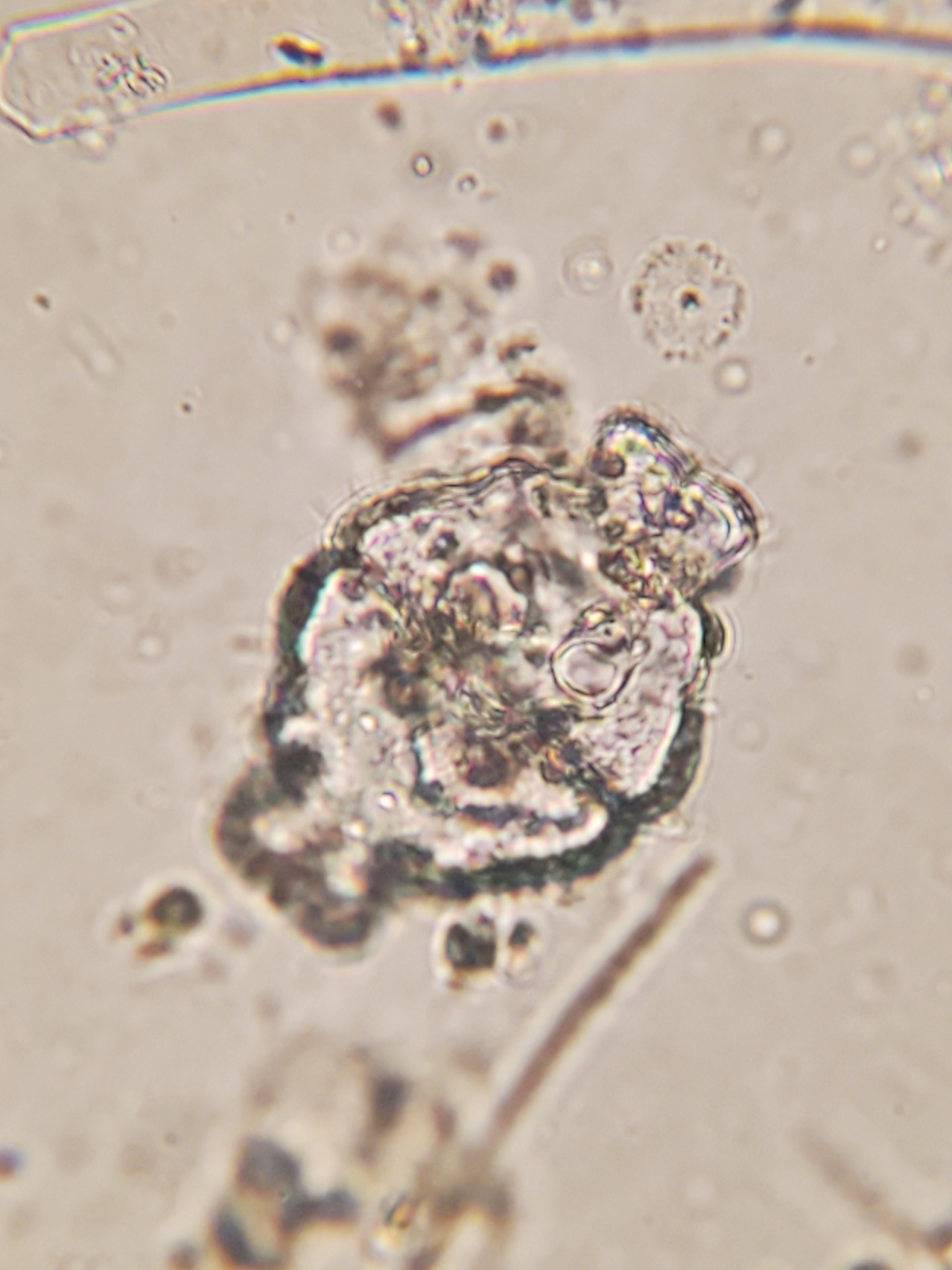 Euastrum ampullaceum