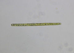Pleurotaenium