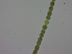 Dolichospermum