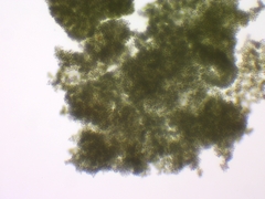 Microcystis