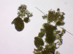 Microcystis