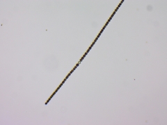 Dolichospermum
