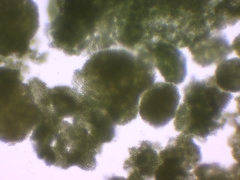 Microcystis