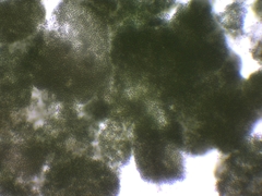 Microcystis