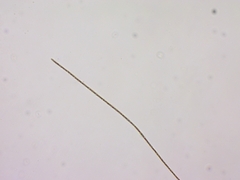 Planktothrix