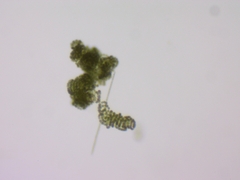 Dolichospermum