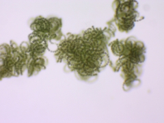 Dolichospermum