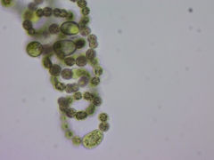 Dolichospermum