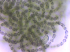 Dolichospermum