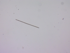 Planktothrix