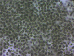 Microcystis