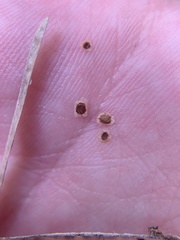 Borodinia canadensis