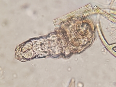 Rotifera