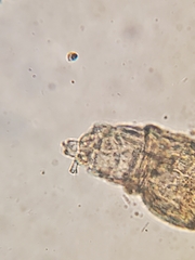 Rotifera