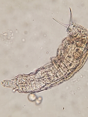 Rotifera