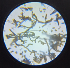 Aspergillus