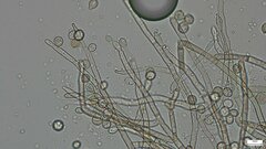 Botryobasidium