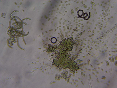 Dolichospermum
