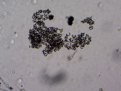 Dolichospermum