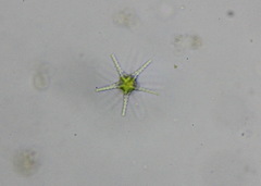 Staurastrum arachne