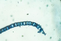 Sphagnum subsecundum