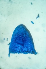 Sphagnum subsecundum