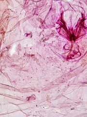 Diaspidiotus ostreaeformis