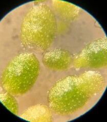 Wolffia brasiliensis