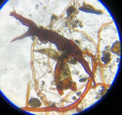 Ephemerum spinulosum